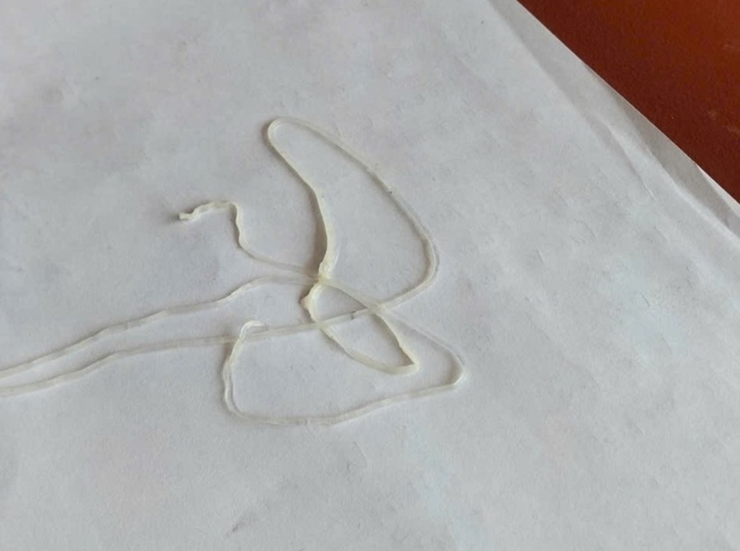 Giun rồng trưởng thành có thể dài tới 1,2 mét, chui ra khỏi cơ thể qua da, gây viêm, đau dữ dội, nguy cơ nhiễm trùng nặng nếu không được xử lý đúng cách. Ảnh: Pháp luật Việt Nam.