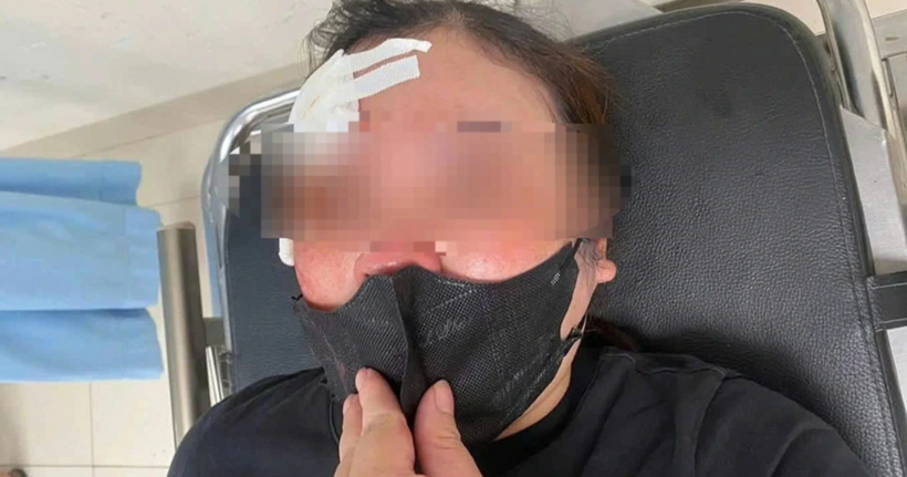 Hình ảnh chị M. bị đánh gây thương tích. (Ảnh: NVCC)