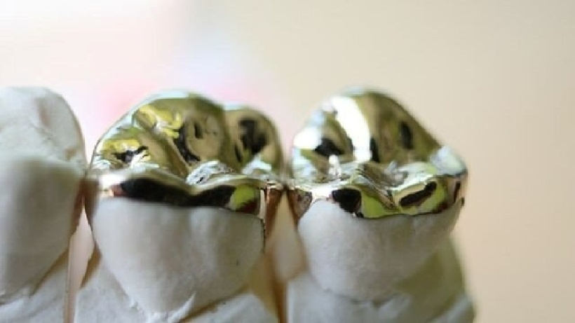 Nhân viên nhà tang lễ đúc vàng từ răng người đã khuất, gây xôn xao Thái Lan.