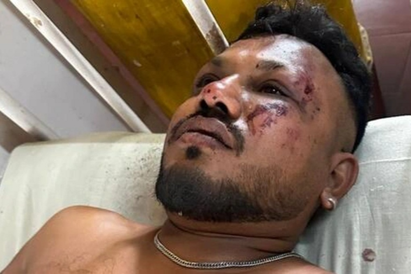 Ramesh Viswashkumar - nam hành khách thoát chết sau vụ tai nạn máy bay chở 242 người.&nbsp; Ảnh: Hindustan Times.