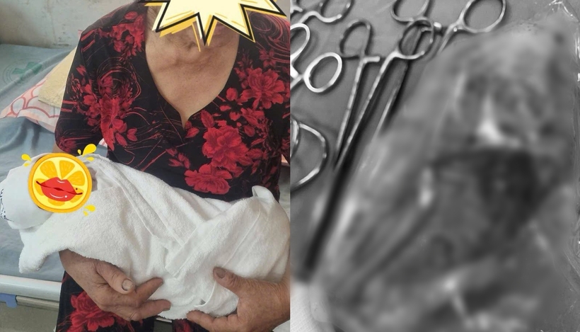 Bé trai chào đời an toàn, sản phụ cũng được phẫu thuật bóc tách khối u quái. Ảnh: VietNamNet