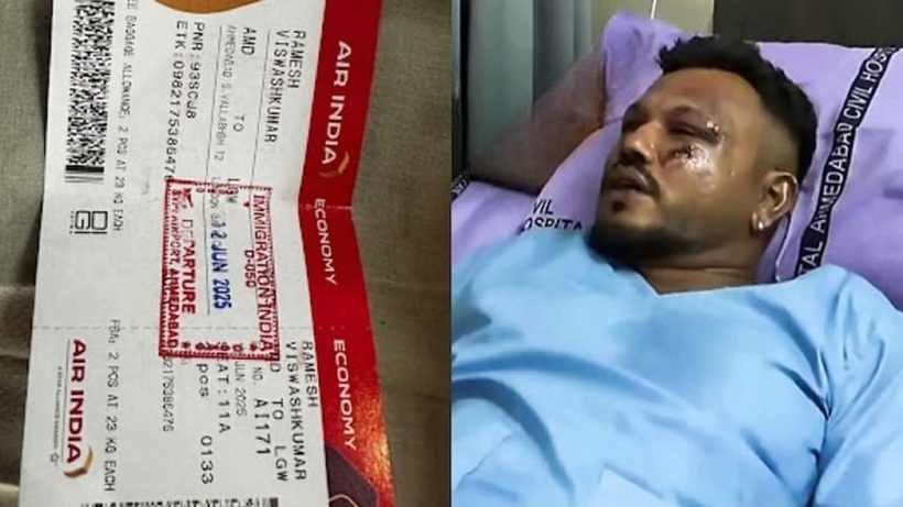 Vishwas Kumar Ramesh - nam hành khách duy nhất sống sót sau vụ rơi máy bay. Ảnh: NDTV