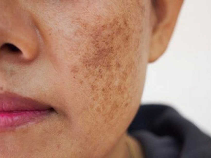 Đừng bỏ qua "4 đen, 2 hôi" trên cơ thể, có thể gan bạn đang gặp nguy! - 1