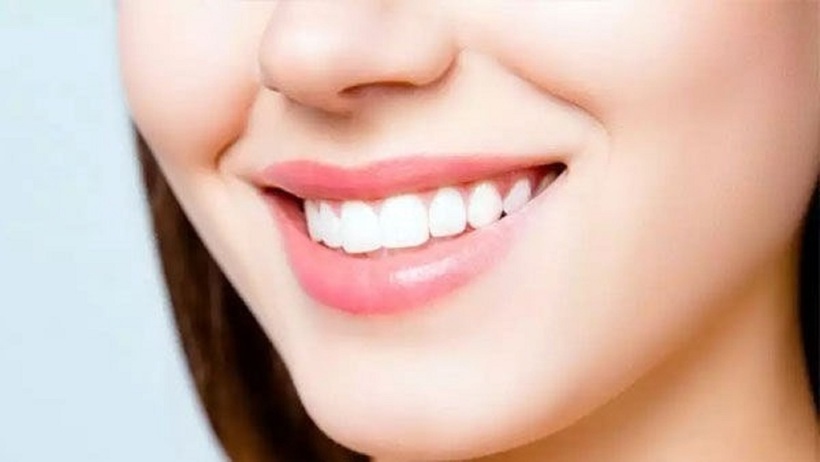 Tác hại của cười nhiều - 1