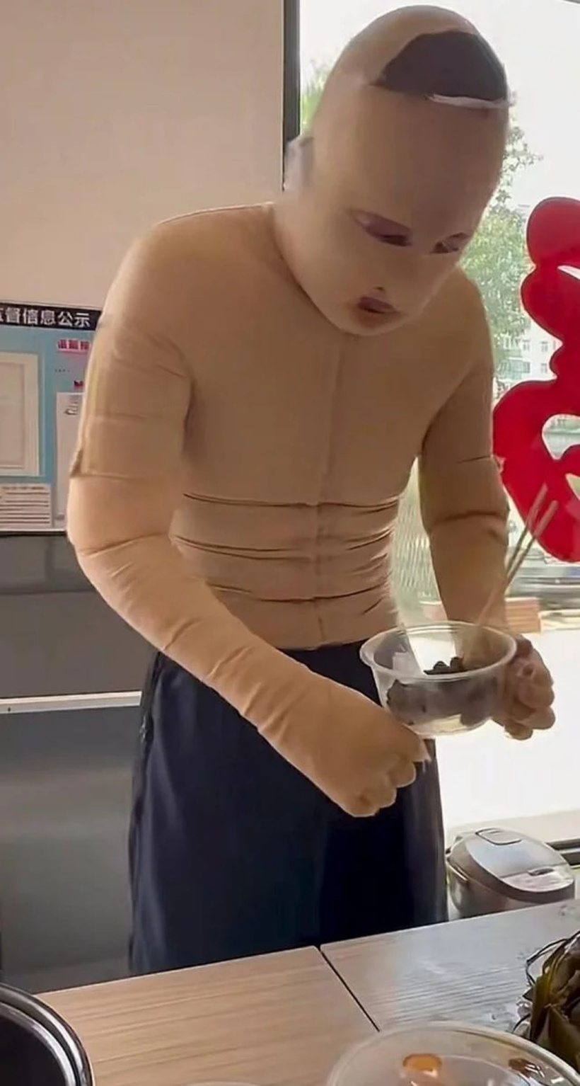 Du bị bỏng nặng, tổn thương nghiêm trọng.