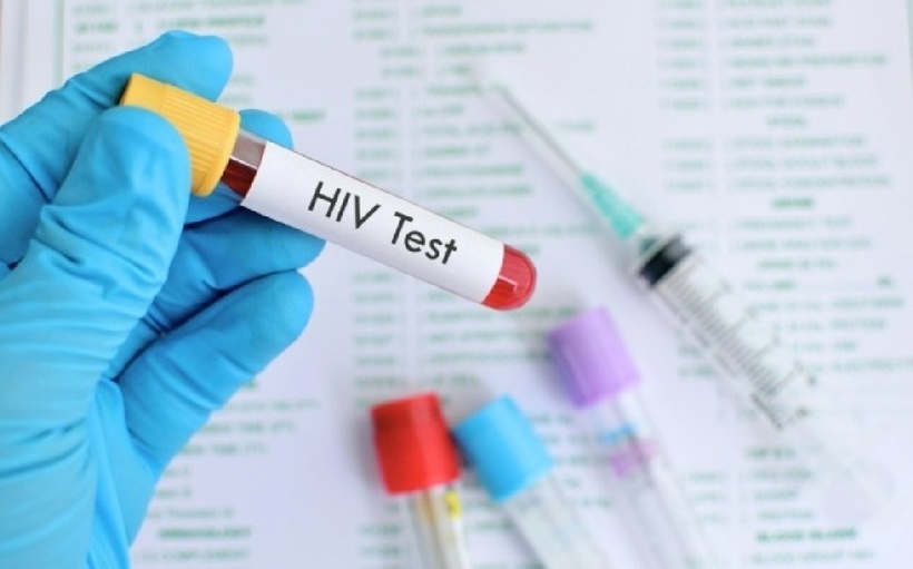 Chồng nói bị "bệnh gan" để giấu nhiễm HIV suốt 10 năm. Ảnh minh họa.