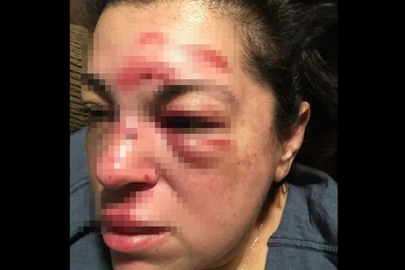 Justine Gurrola bị ngã khi đang đi dạo trên vỉa hè thành phố Whittier, bang California, tháng 2/2018. Ảnh: NBC