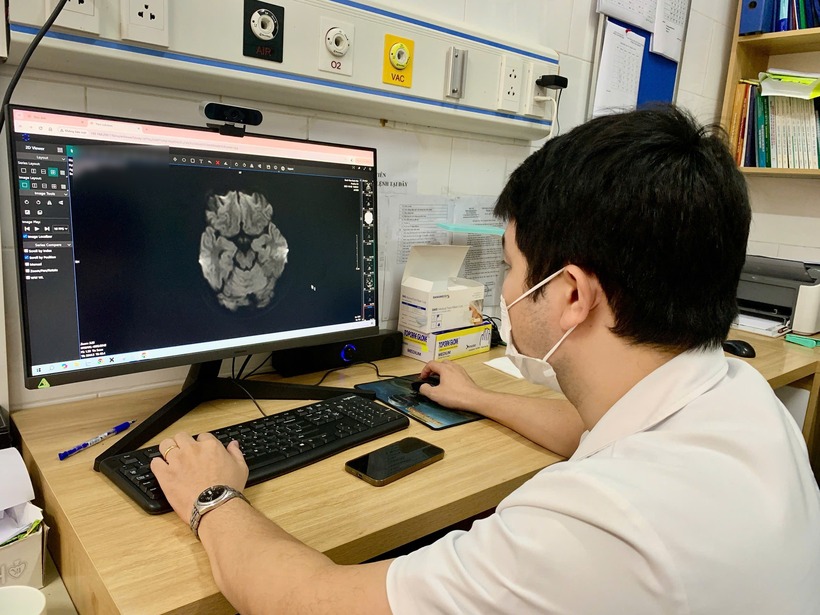 Hình ảnh não của nam sinh bị tổn thương do dùng thuốc lá điện tử có chứa cần sa. Ảnh: Báo Xây dựng.