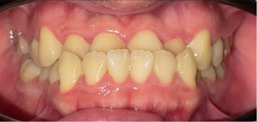 Nam tiktoker từng đau đầu kinh niên, tưởng liên quan đến bệnh thần kinh, đi khám nhiều nơi không khỏi. Ảnh: NVCC