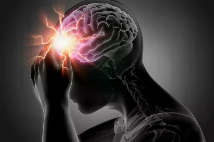 Nên làm gì để ngừa đột quỵ từ sớm? - 2