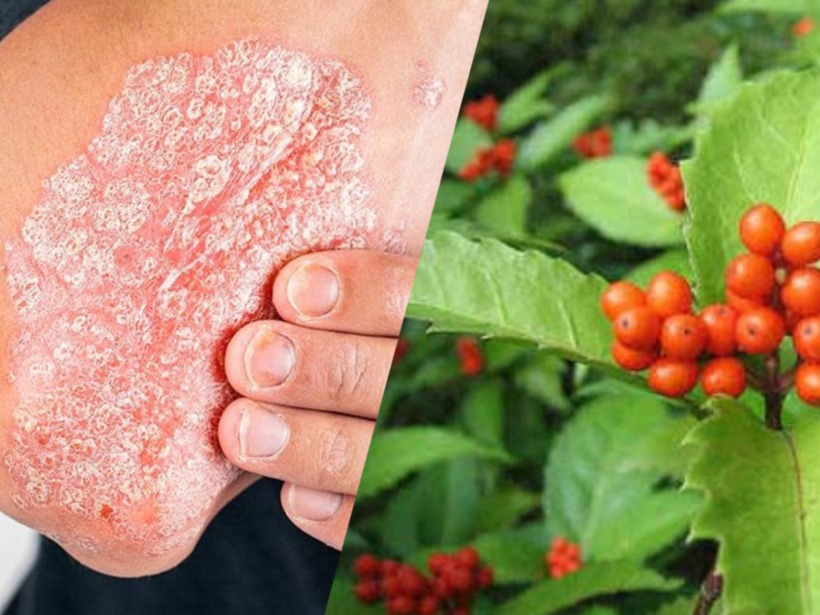 Sói rừng là thảo dược nổi tiếng trong hỗ trợ kiểm soát bệnh vảy nến