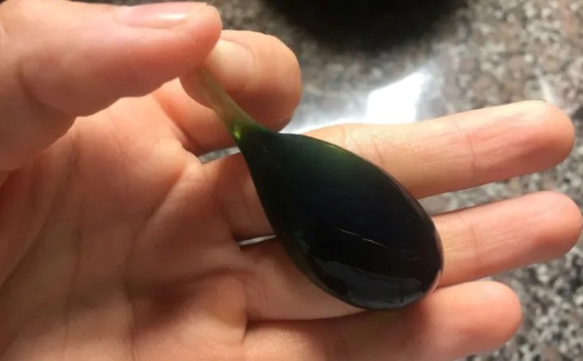 Nữ bệnh nhân 66 tuổi suýt tử vong sau khi uống mật cá trắm để chữa đau đầu, khiến men gan tăng 250 lần, nhanh chóng rơi vào suy gan cấp và nguy cơ suy thận. Ảnh: PLO.