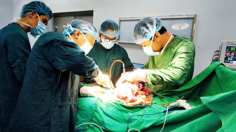 Bác sĩ phẫu thuật lấy khối u buồng trứng. Ảnh: Sức khỏe & Đời sống.