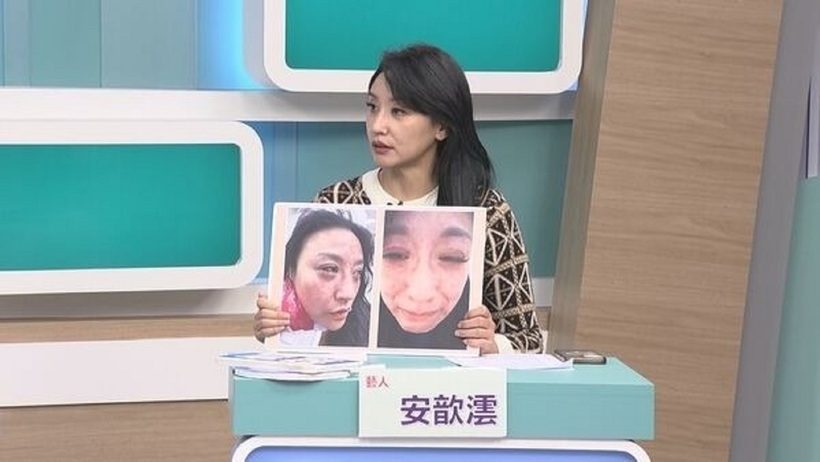 Tâm Vân kể lại việc bị chồng bạo hành, dọa giết. Ảnh: Weibo.