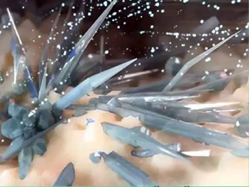 Tinh thể urat tích tụ trong khớp khiến cho cơn gút cấp tái phát