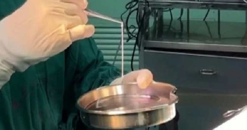 Con sán dài khoảng 10 cm, màu trắng xám, còn sống trong não bệnh nhân. Ảnh: Saostar.