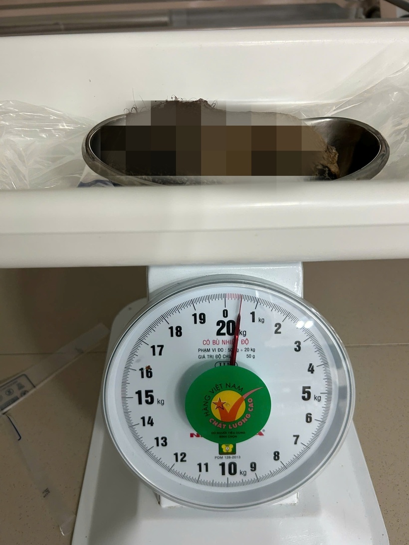 Búi tóc 0,5kg được các bác sĩ lấy ra khỏi dạ dày bệnh nhi. Ảnh: Phụ nữ TP.HCM.
