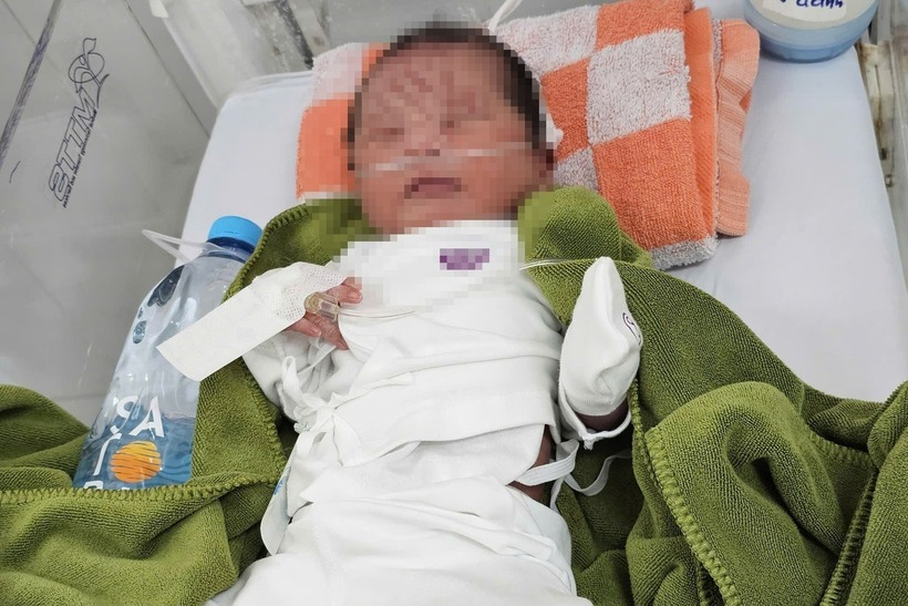 May mắn, sức khỏe của bé đã ổn định. (Ảnh: Dân trí)