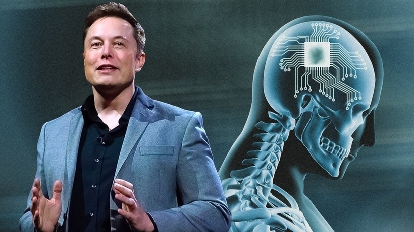 Công ty của elon musk đạt đột phá công nghệ với thời gian cấy ghép không tưởng. Ảnh:&nbsp;Wccftech.