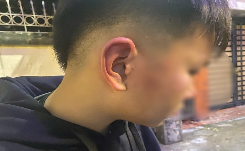 Tình trạng của bé trai sau vụ việc. (Ảnh: Dân Việt)