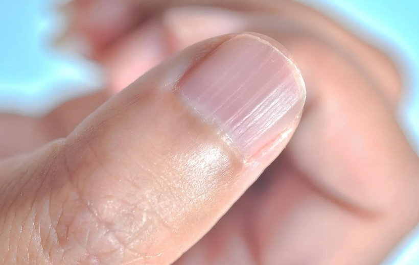 Người khỏe mạnh, móng tay thường phẳng và mịn.
