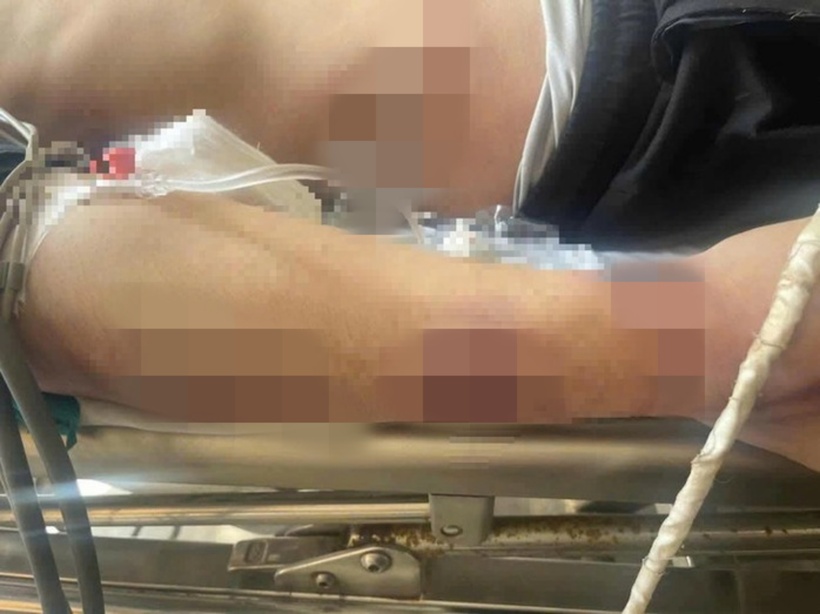 Học viên P.H.N. được đưa đi cấp cứu với nhiều vết thương trên người. Ảnh: NLĐ.