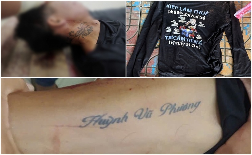 Một số đặc điểm nhận dạng của nạn nhân. (Ảnh: Công an nhân dân)