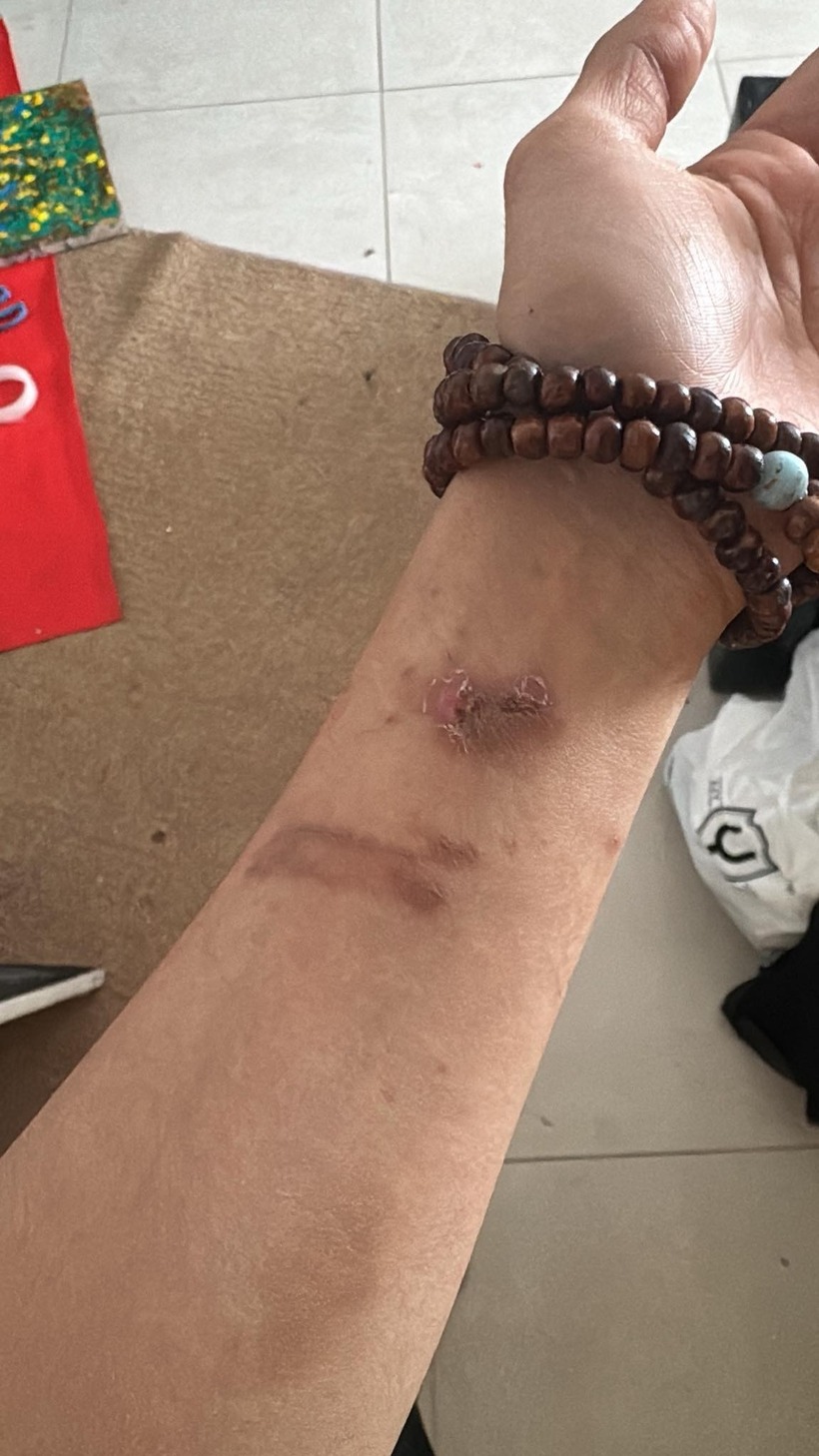 Nam diễn viên gặp sự cố hỏa hoạn, bị bỏng và ngạt khói - 2