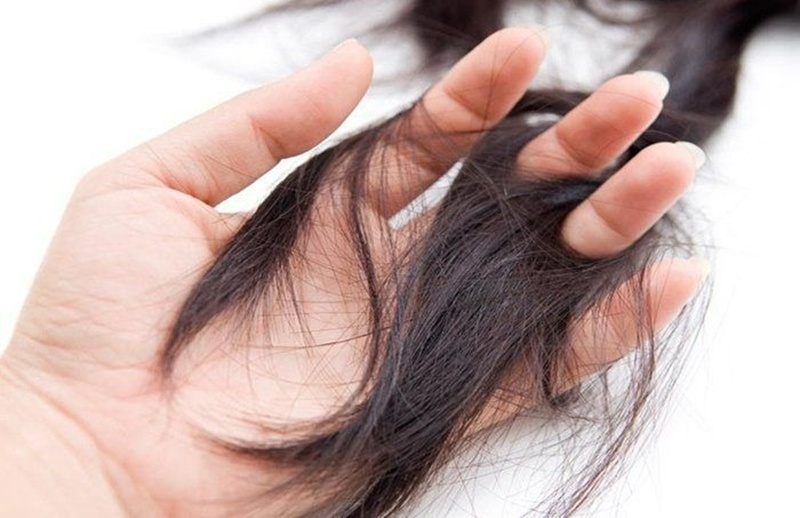 Tóc ở&nbsp;bệnh thận&nbsp;mạn tính thường giòn và khô, dễ gãy ngay cả khi chải nhẹ nhàng.