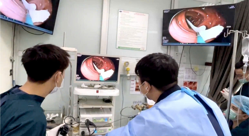 Nội soi phát hiện một đoạn sán màu trắng ngà, dài hơn 80cm đang di chuyển trong lòng đại tràng