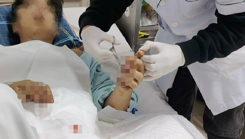 Nhiều ca nguy kịch, di chứng nặng nề do tai nạn pháo nổ. Ảnh: Báo Dân trí.