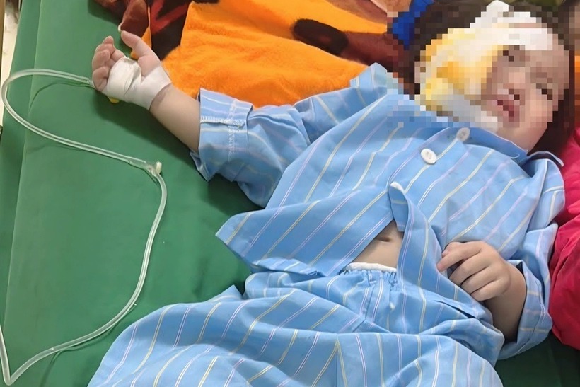 Nạn nhân được các bác sĩ điều trị nhiều vết thương sau tai nạn tại trường học. Ảnh: Dân trí