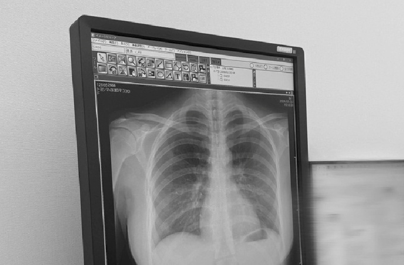 Bức ảnh X-quang của nữ người mẫu Nhật "gây bão" mạng xã hội với 43 triệu view. Ảnh: VnExpress.