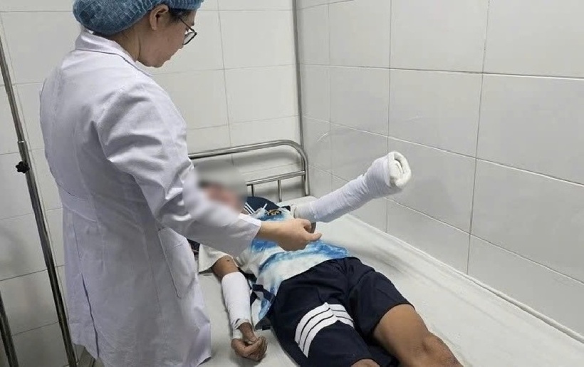 Nam sinh 14 tuổi bị thương nặng do tự chế pháo bằng lưu huỳnh theo video trên mạng. Ảnh: Vietnamnet.