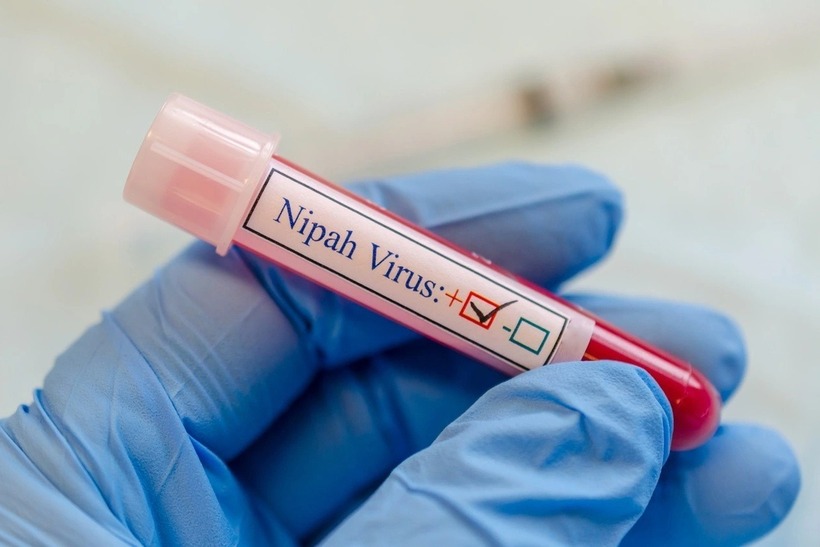 Hiện chưa có thuốc đặc trị hay vaccine Nipah dùng rộng rãi cho cộng đồng. Ảnh minh họa: Getty