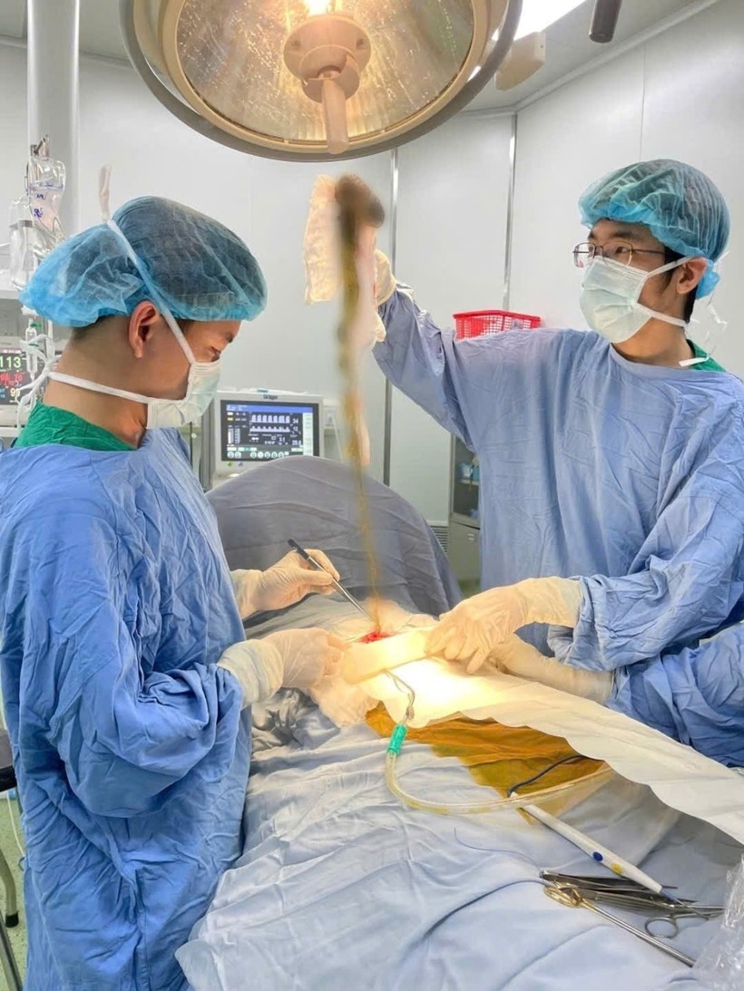 Các bác sĩ phẫu thuật cho bệnh nhân. Ảnh: Công lý.