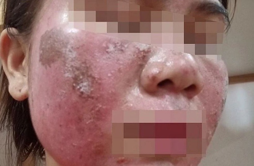 Chị em không nên tin những quảng cáo có cánh về sản phẩm làm đẹp "thần tốc", kẻo tiền mất tật mang. Ảnh: VTC News.