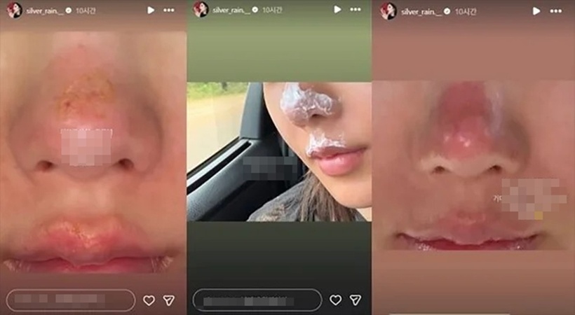 Kwon Eun Bi gây xôn xao khi đăng tải story chia sẻ về tình trạng sức khỏe. Ảnh: Saostar.