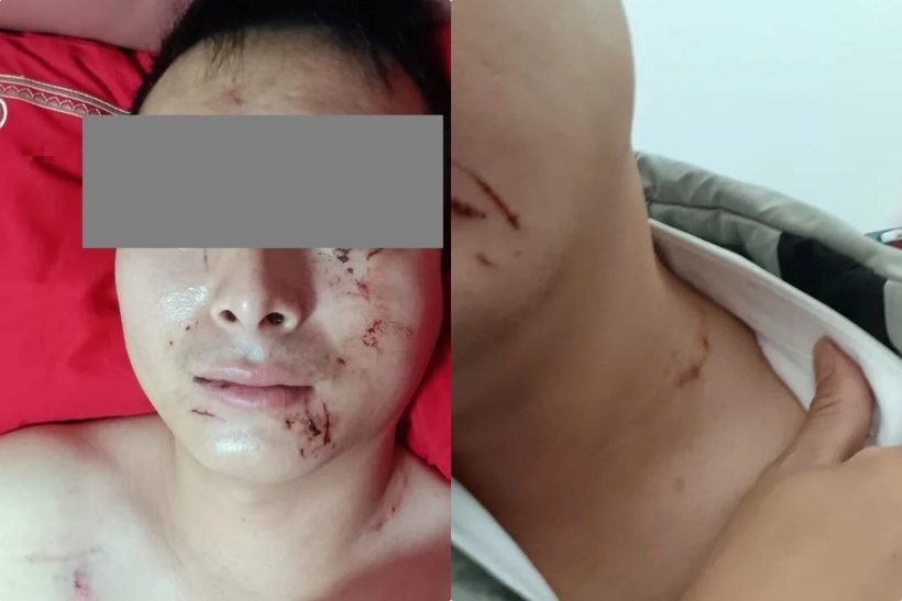 Trên mặt anh Lữ có nhiều vết máu. Ảnh: Saostar.