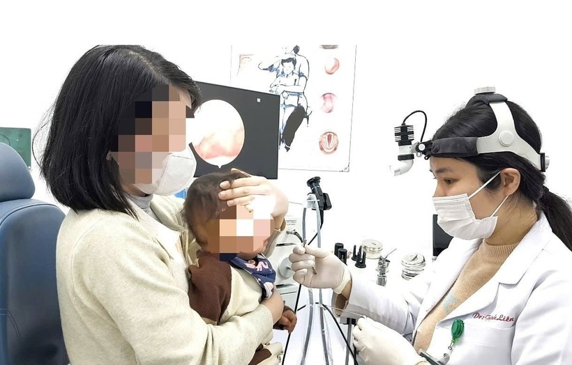 Các bác sĩ tiến hành gắp dị vật cho bệnh nhi. Ảnh: Báo Dân Việt.