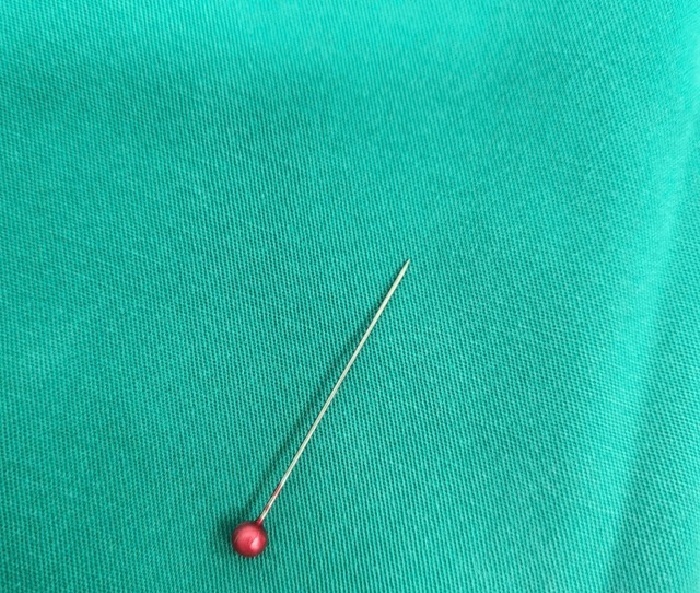 Cây kim dài 3 cm trong đường thở bé trai 13 tháng tuổi ở Cà Mau. Ảnh: Báo Thanh niên.