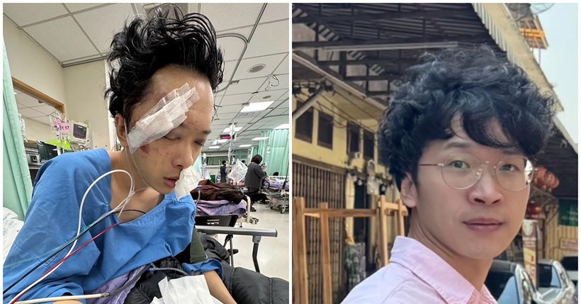 Diễn viên Tô Đức Dương được dự đoán cần mất thời gian dài hồi phục. Ảnh: VietNamnet