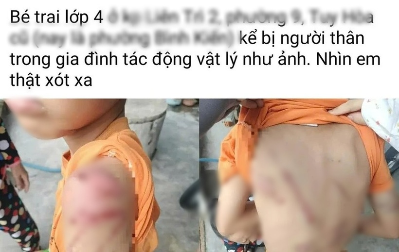 Thông tin, hình ảnh bé trai được đăng tải trên mạng xã hội. Ảnh: Pháp luật TP.HCM