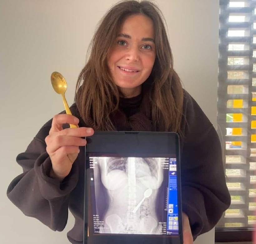 Reymy quyết định giữ lại chiếc thìa như một món kỷ niệm. Ảnh: Jam Press.