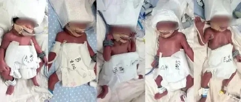 Sản phụ 24 tuổi hạ sinh 5 con tự nhiên. Ảnh: Jimu News.