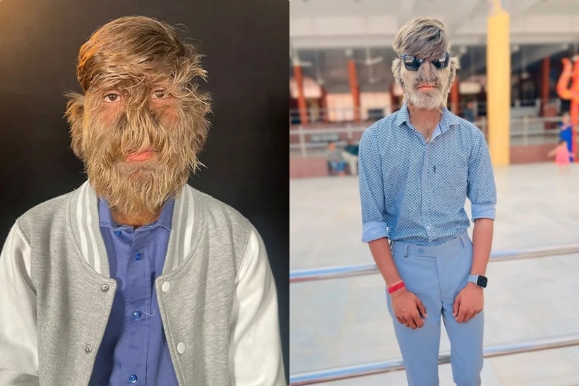 Hiện Lalit hoạt động tích cực trên mạng xã hội, đăng tải các video về cuộc sống thường ngày và những chuyến du lịch. Ảnh: The Sun.