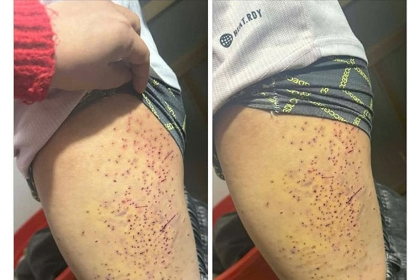 Cơ quan chức năng đang vào cuộc xác minh thông tin nam sinh Trường THCS Mậu A nghi bị bạn dùng vật nhọn hành hung, hiện đang lan truyền trên mạng. Ảnh: Lao Động.