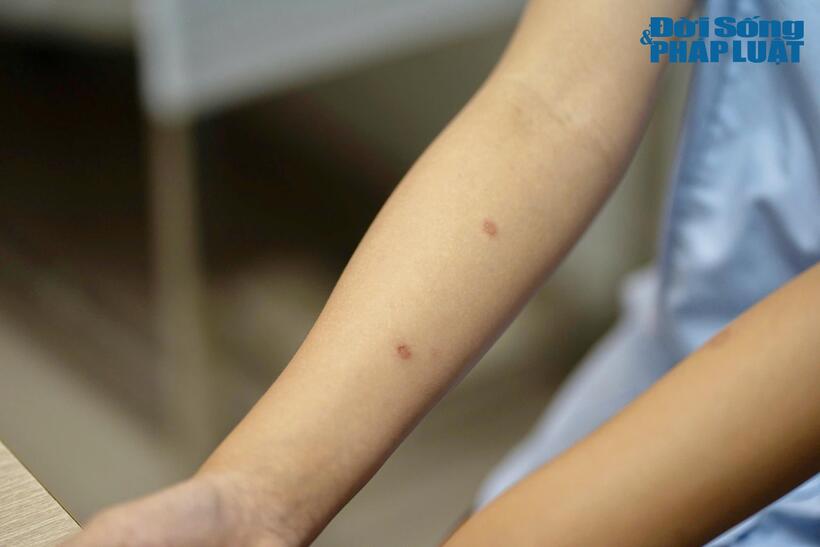 Các bệnh lý thường gặp nhất trong mùa này bao gồm: rôm sảy (ở trẻ em), nấm da (thân, bẹn, kẽ chân), viêm nang lông, mụn trứng cá và dị ứng ánh nắng