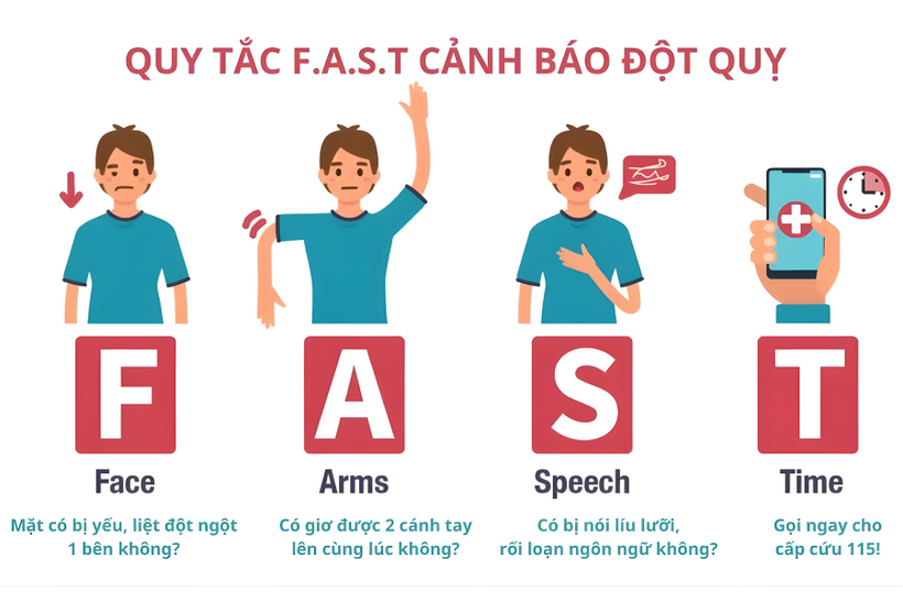 Nhận biết sớm dấu hiệu tai biến mạch máu não theo quy tắc FAST giúp tăng cơ hội sống cho người bệnh