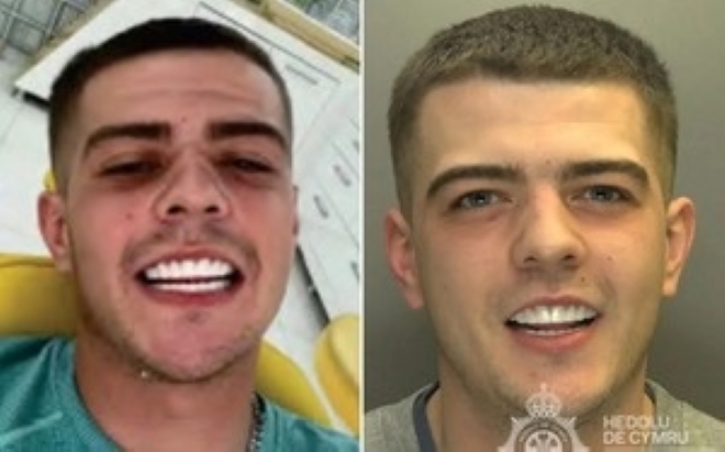 Coran khoe hàm răng trắng sáng sau thẩm mỹ của mình cho bạn, mà không biết được rằng điện thoại của bạn lại đang nằm trong tay cảnh sát.